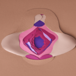 Newport Beach Vaginal rejuvenation