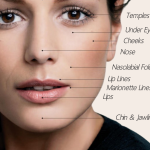Fillers Newport Beach Dermatology