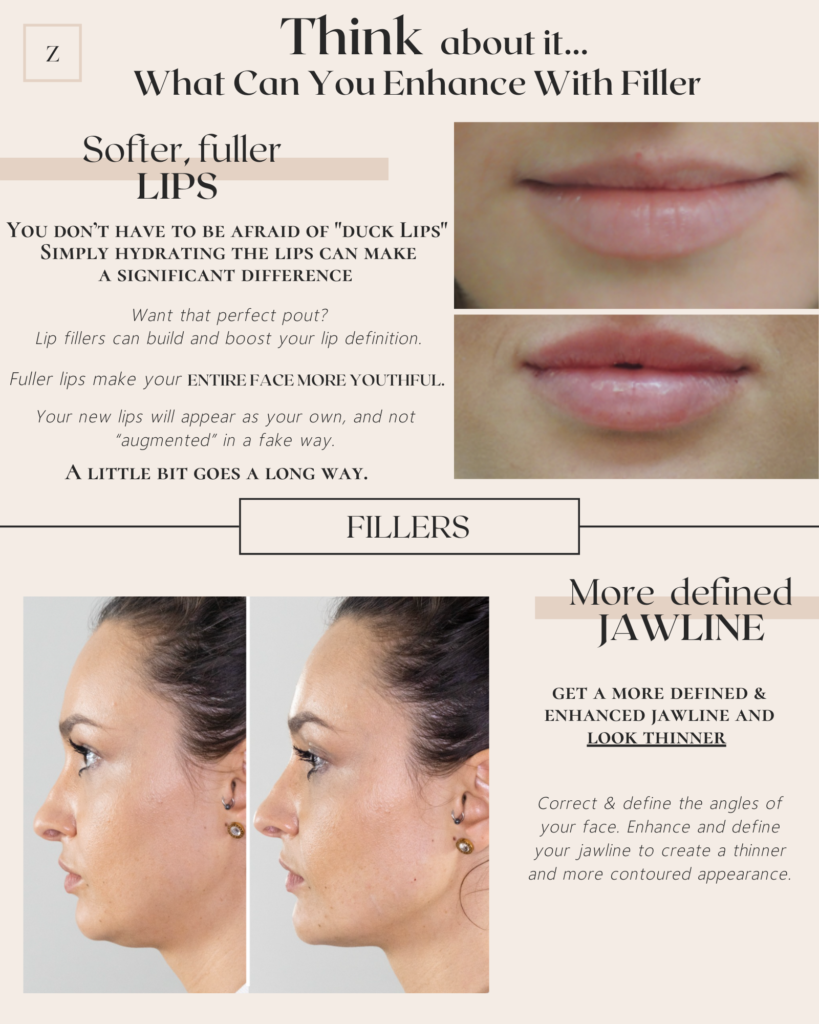 Fillers Newport Beach Dermatology