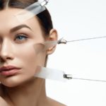Threadlift Newport Beach