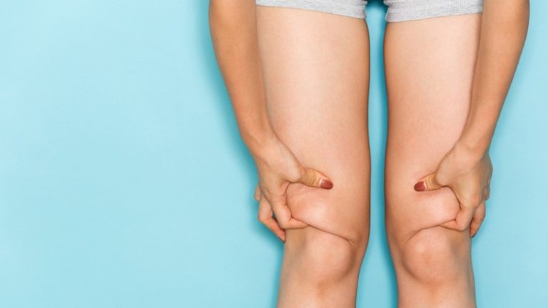 Thermage Newport Beach