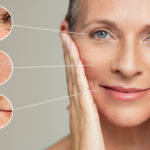 Skin Care Newport Beach