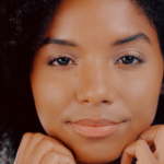 RF Microneedling Newport Beach