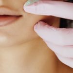 Dermal Fillers Newport Beach