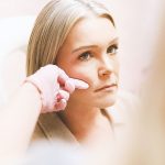 XERF radiofrequency skin tightening treatment at ZENA Medical Newport Beach